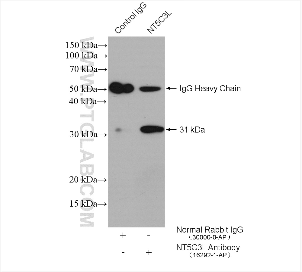 IP experiment of mouse testis using 16292-1-AP