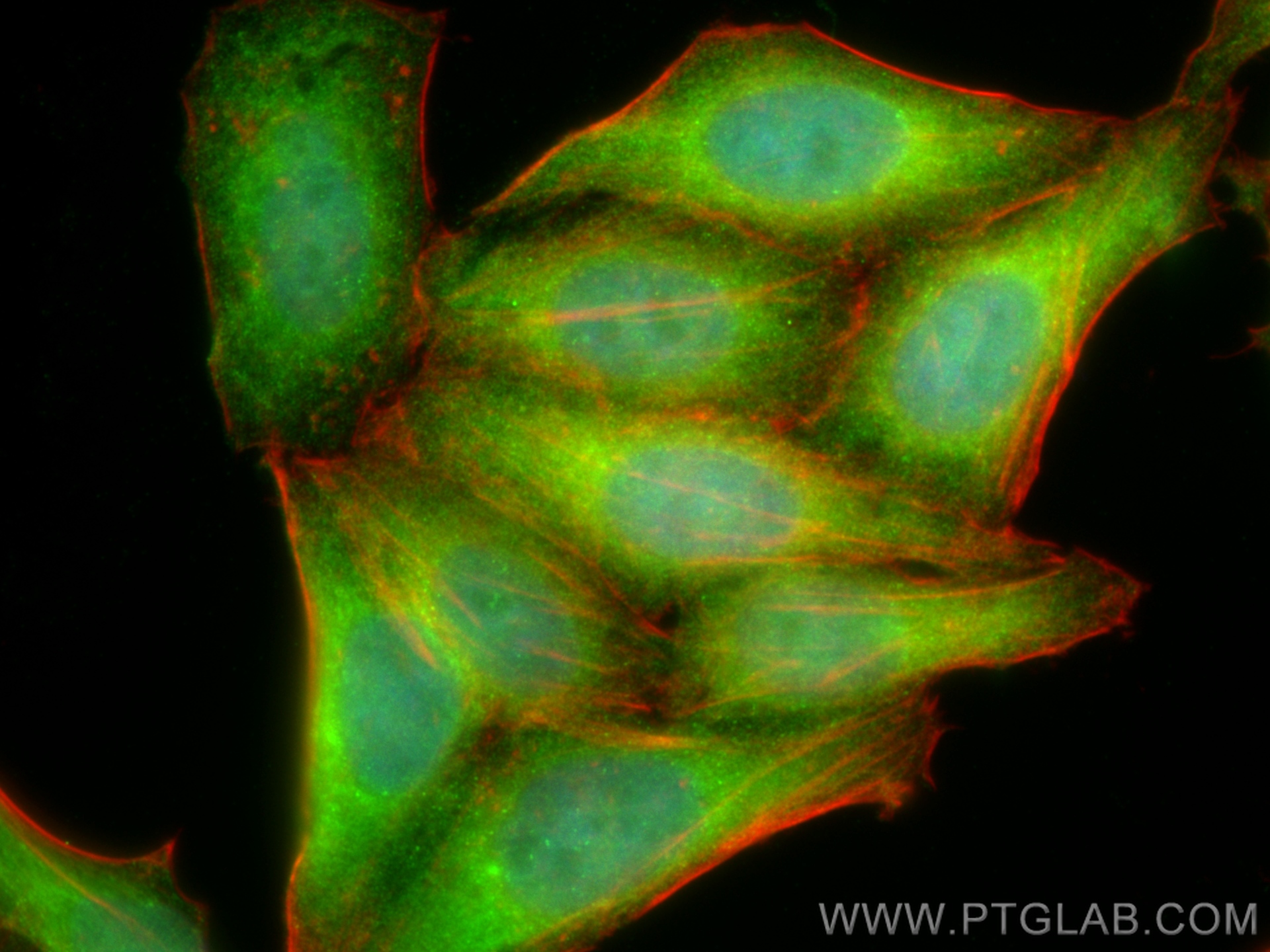 IF Staining of HepG2 using 24102-1-AP