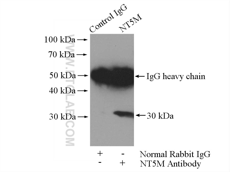 IP experiment of mouse skeletal muscle using 20765-1-AP