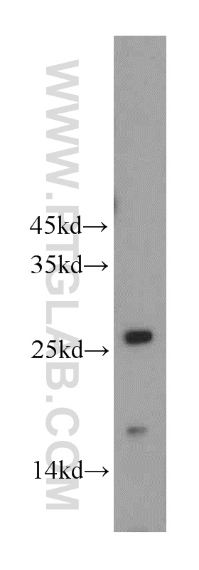 WB analysis of mouse brain using 20765-1-AP