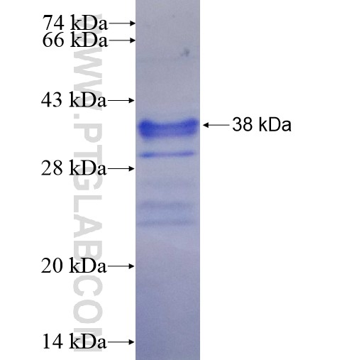 NT5M fusion protein Ag14983 SDS-PAGE NT5M fusion protein Ag14983 SDS-PAGE