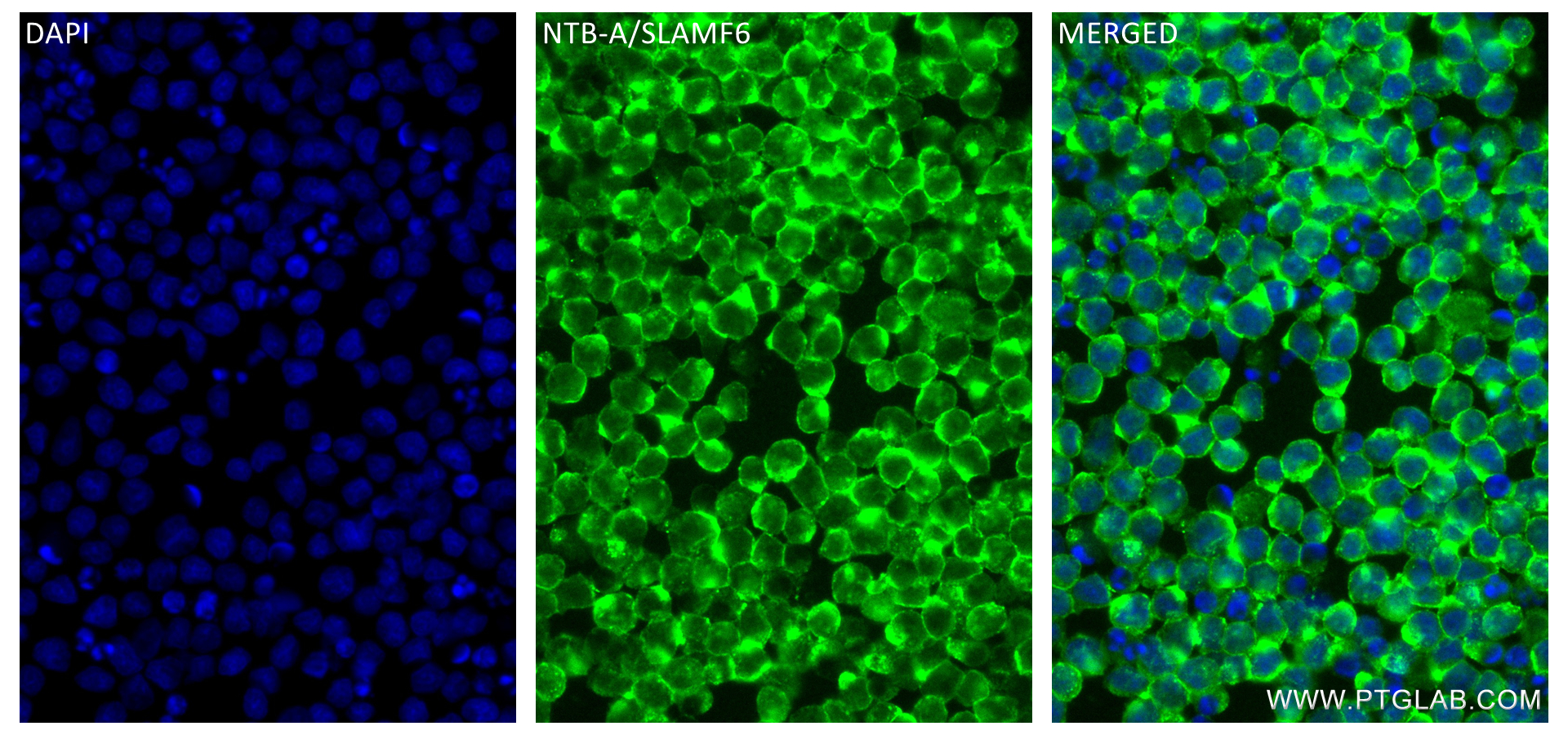 IF Staining of Ramos using 84211-4-RR (same clone as 84211-4-PBS)