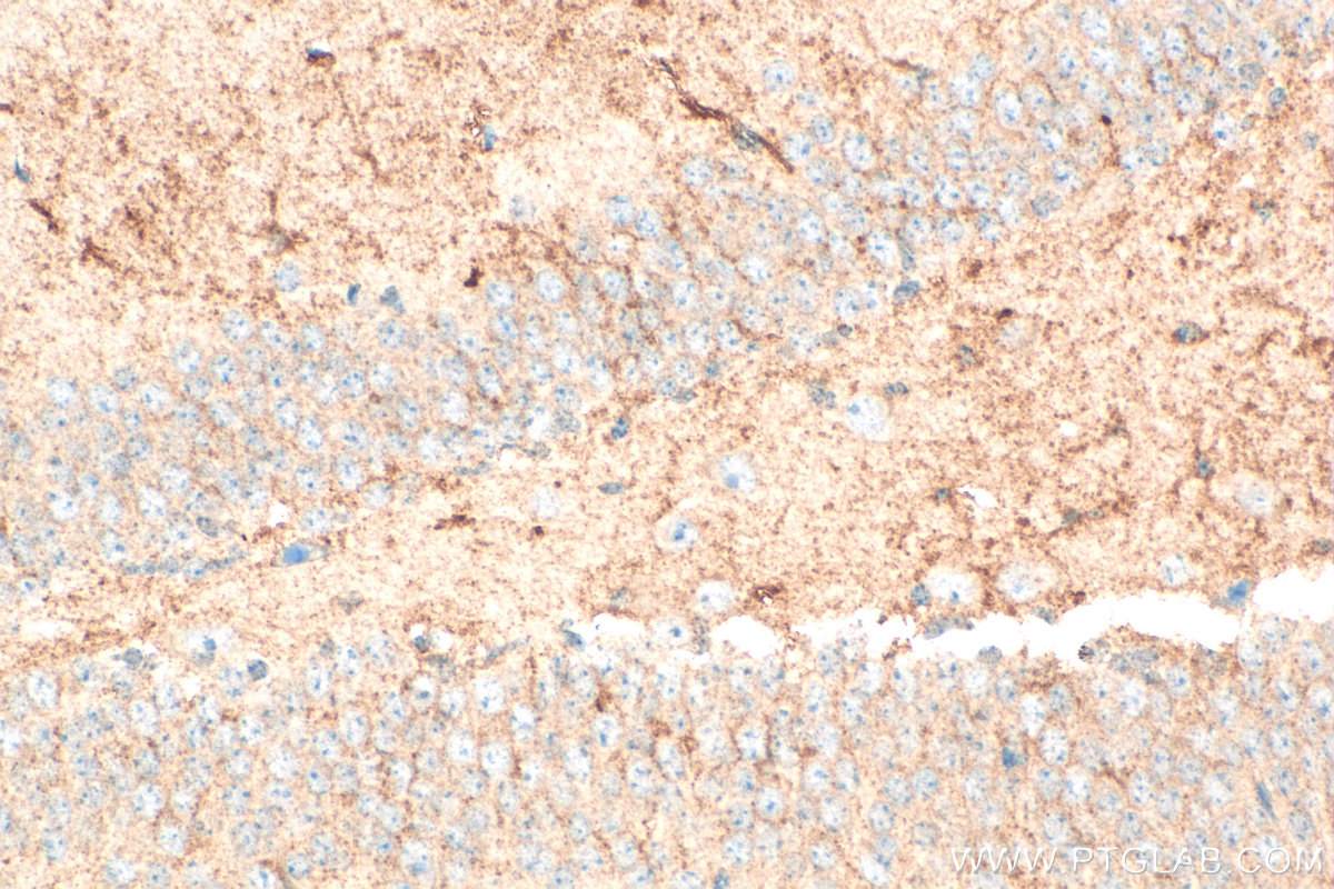IHC staining of mouse brain using 18084-1-AP