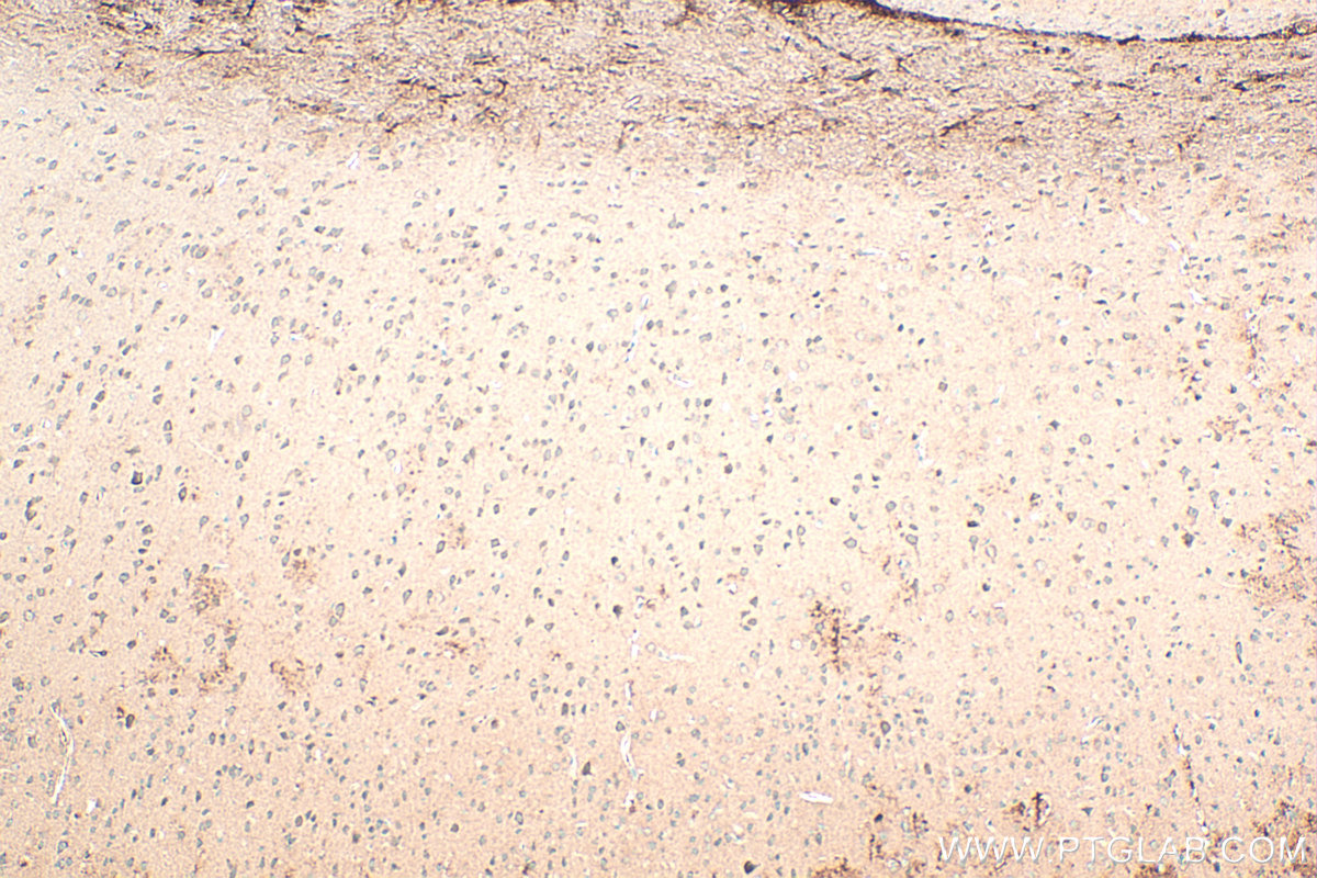 IHC staining of mouse brain using 18084-1-AP