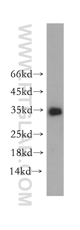 WB analysis of SH-SY5Y using 18084-1-AP