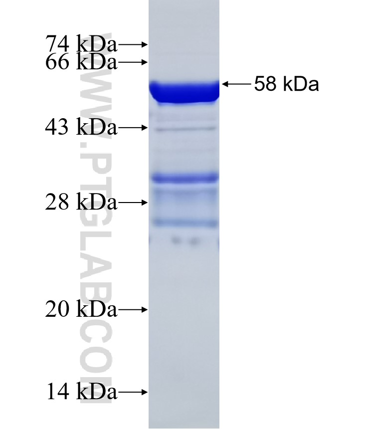 NTHL1 fusion protein Ag1631 SDS-PAGE