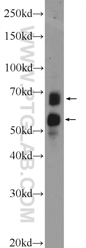 WB analysis of SH-SY5Y using 14373-1-AP