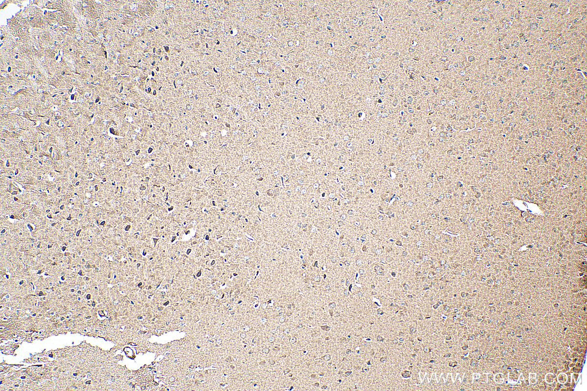 IHC staining of mouse brain using 13129-1-AP