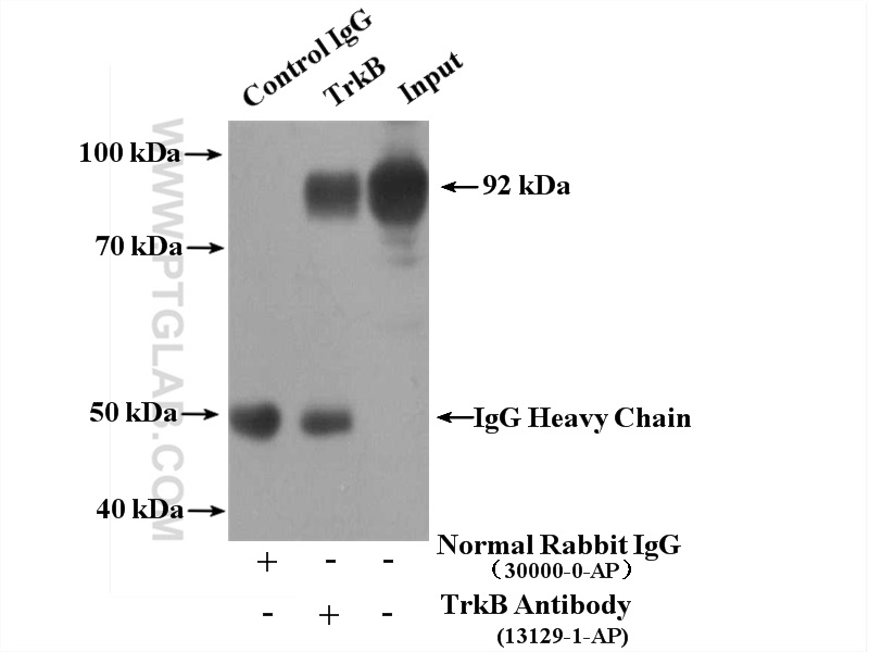 IP experiment of mouse cerebellum using 13129-1-AP