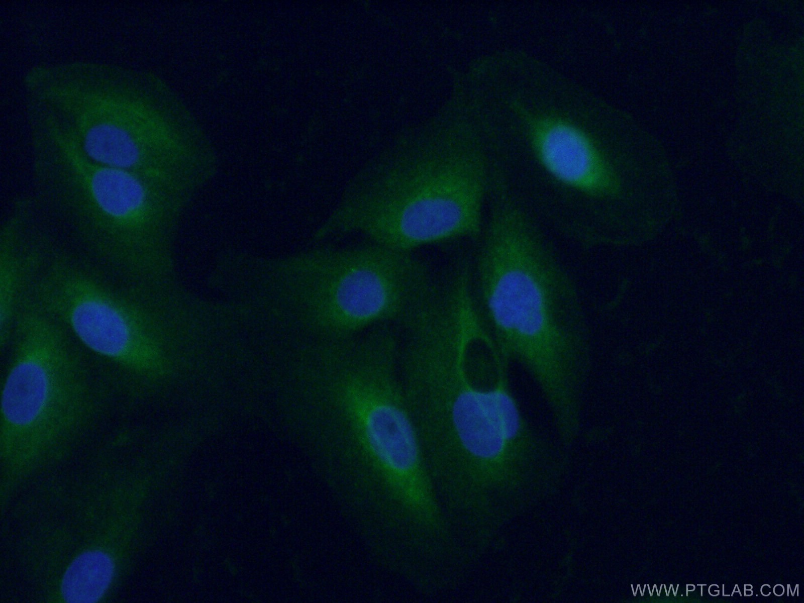 IF Staining of A549 using 11999-1-AP