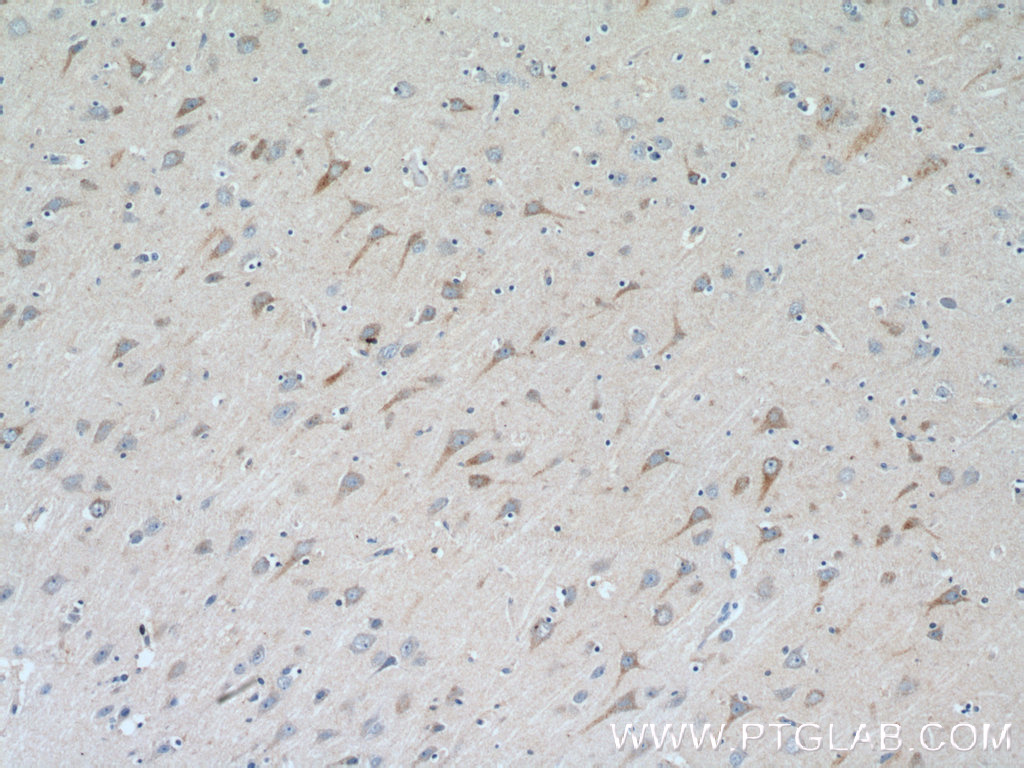 IHC staining of human brain using 11999-1-AP