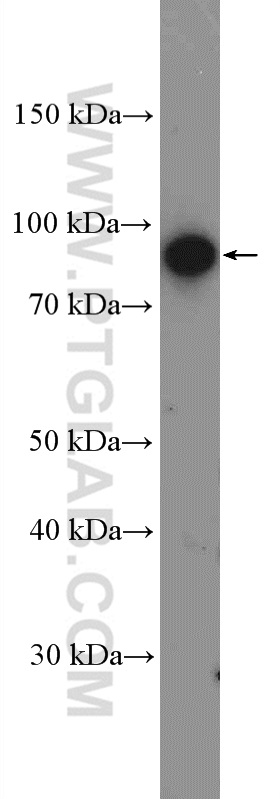 WB analysis of fetal human brain using 11999-1-AP