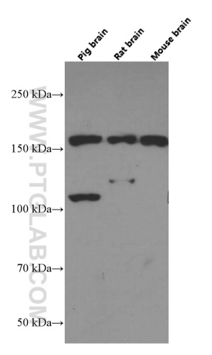 TrkC Monoclonal antibody