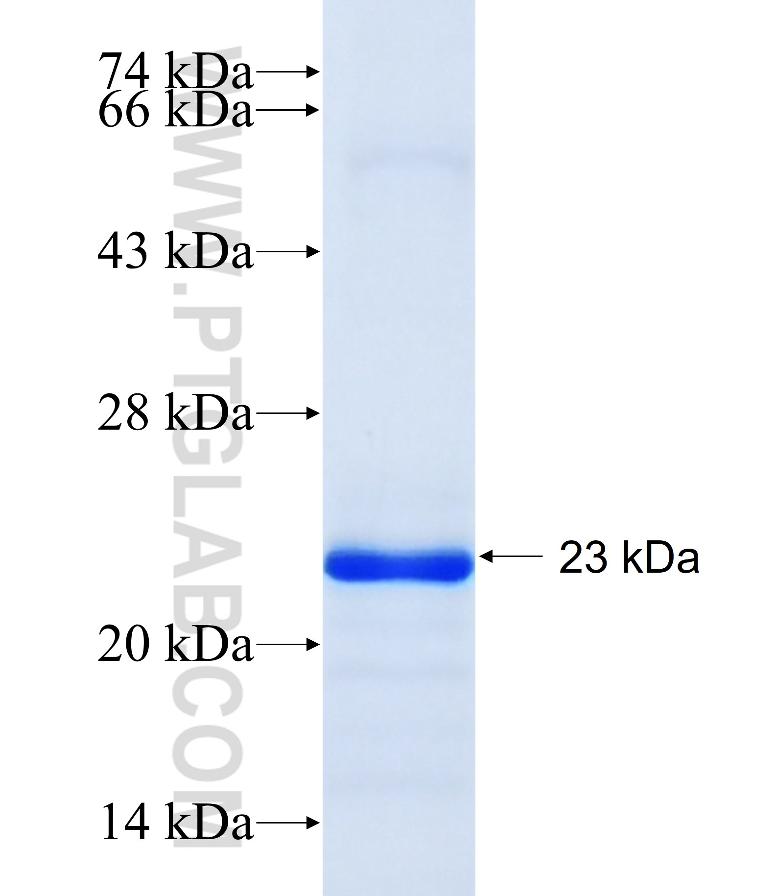 NUAK2 fusion protein Ag35352 SDS-PAGE NUAK2 fusion protein Ag35352 SDS-PAGE