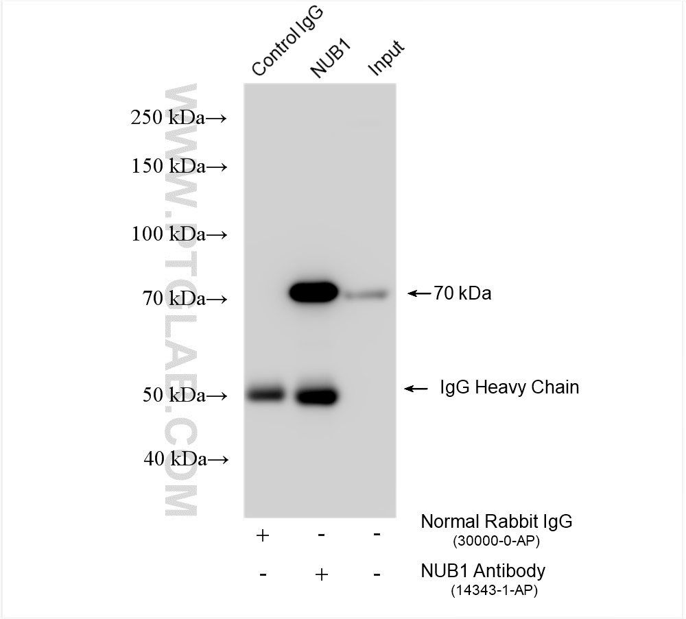 IP experiment of HEK-293 using 14343-1-AP