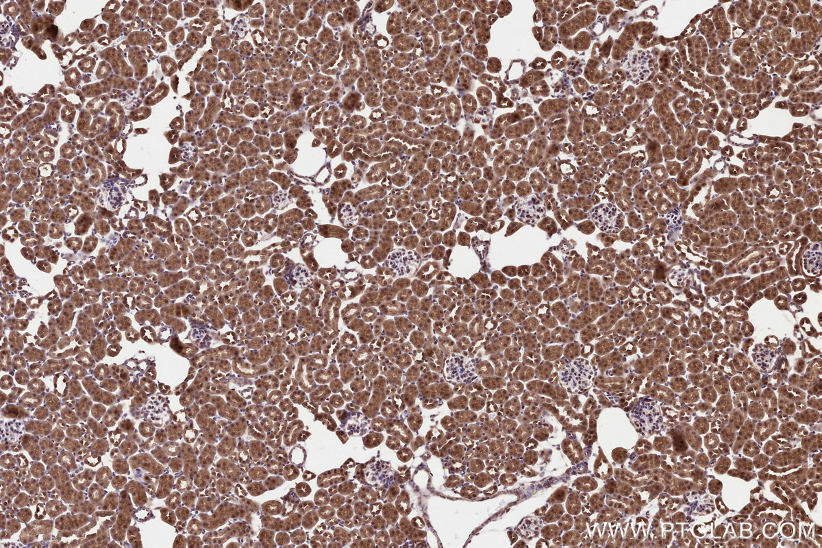 IHC staining of mouse kidney using 18011-1-AP IHC staining of mouse kidney using 18011-1-AP
