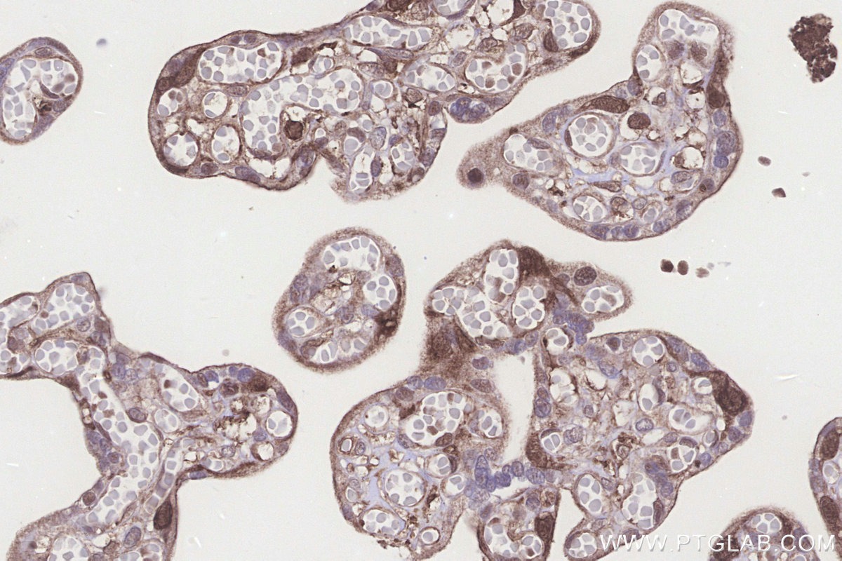 IHC staining of human placenta using 18011-1-AP IHC staining of human placenta using 18011-1-AP