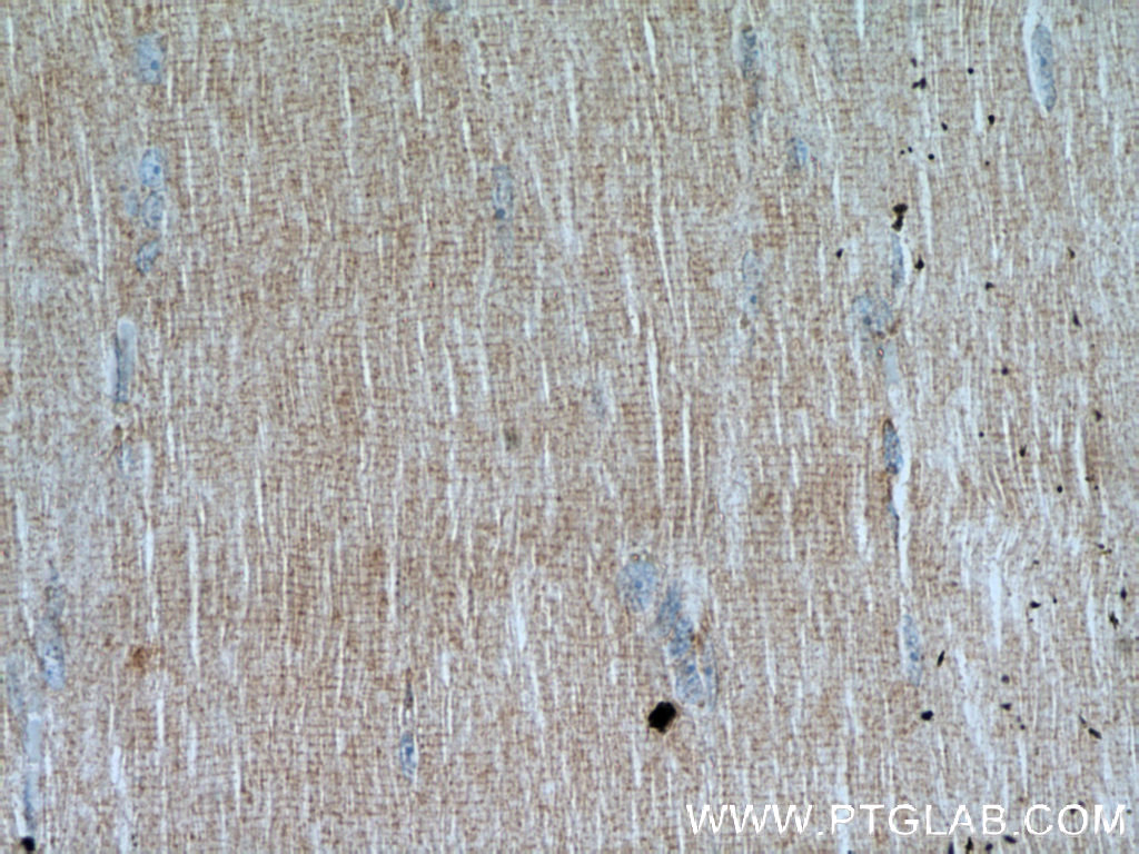 IHC staining of human skeletal muscle using 15409-1-AP