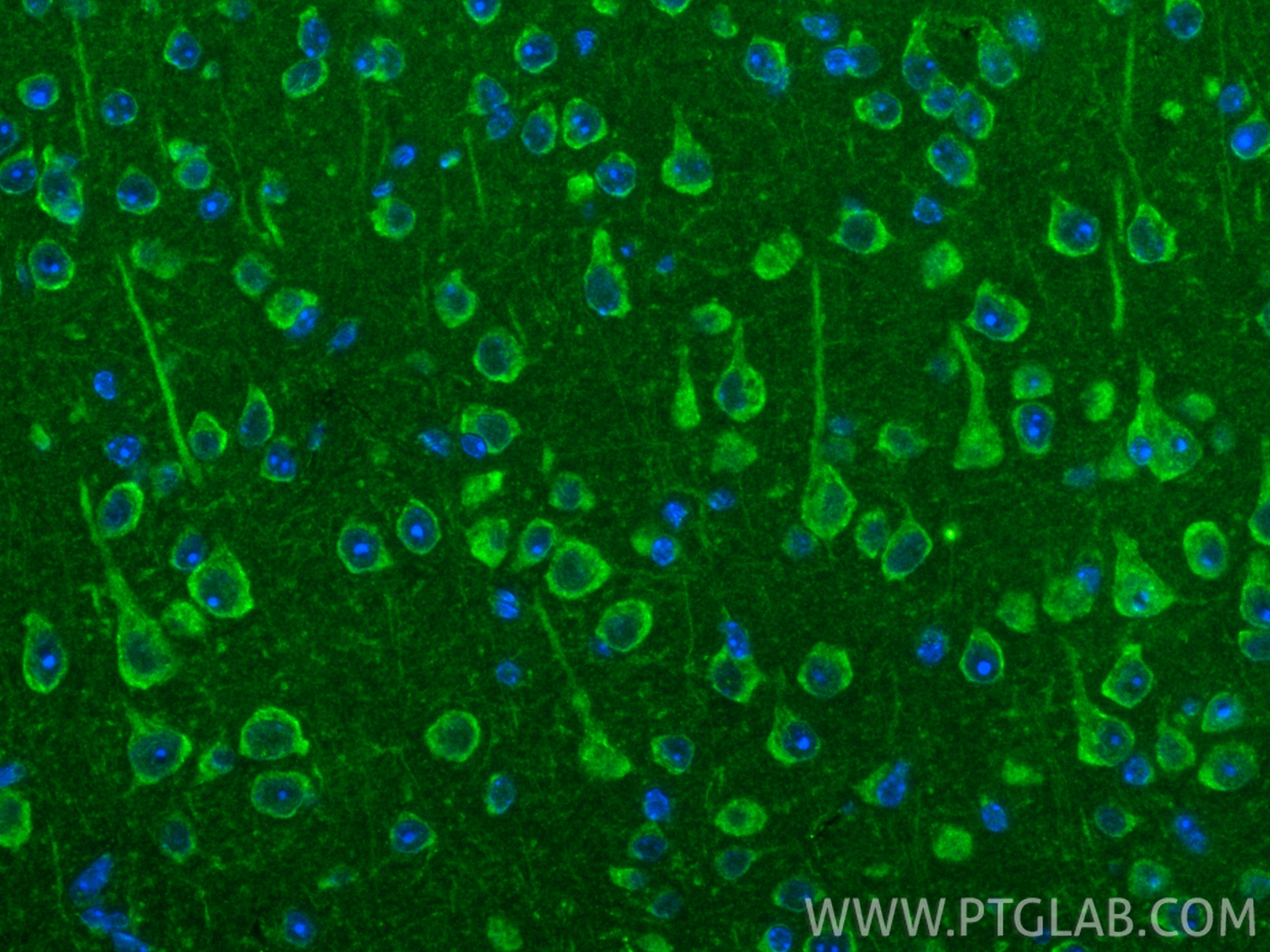 IF Staining of mouse brain using 17393-1-AP