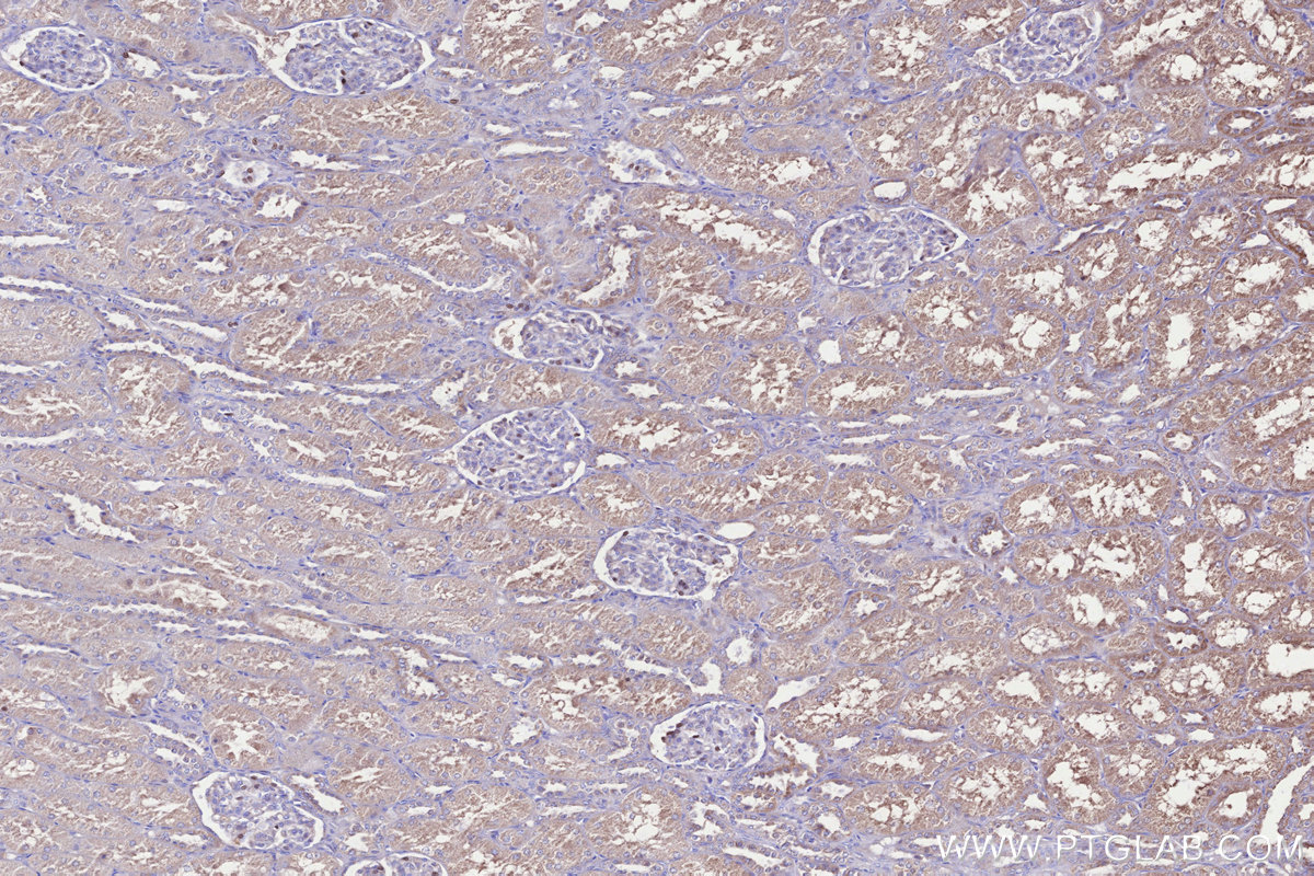 IHC staining of human kidney using 17393-1-AP IHC staining of human kidney using 17393-1-AP