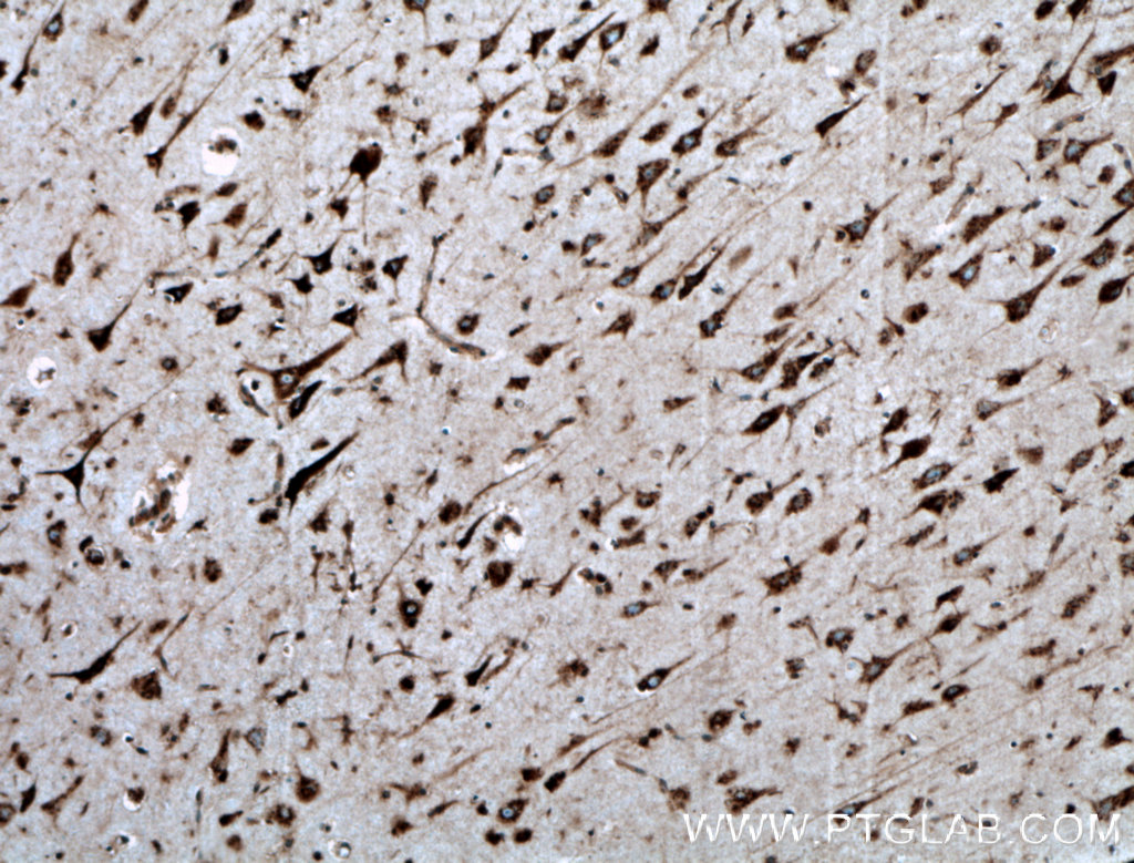 IHC staining of human brain using 10228-1-AP