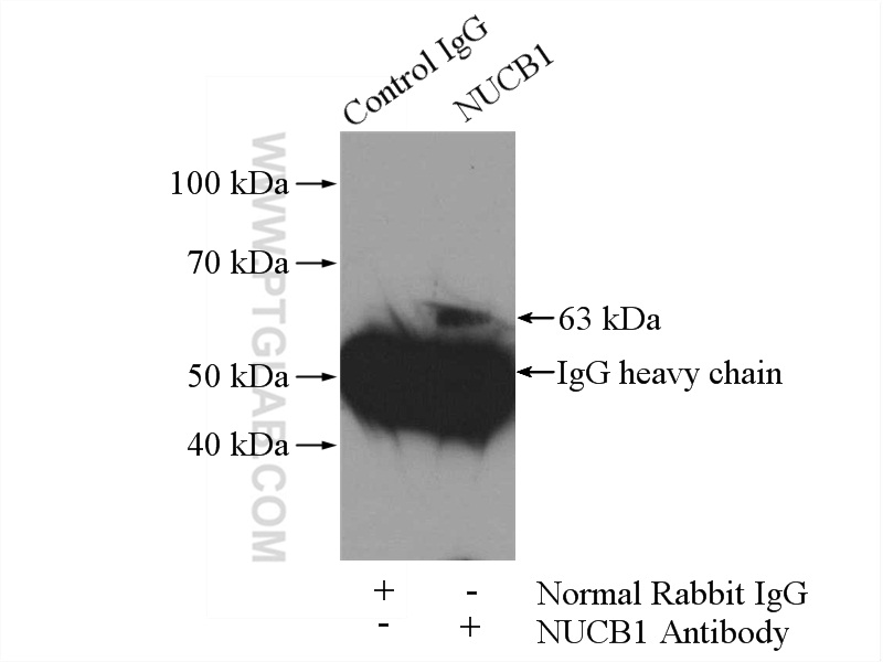 IP experiment of HepG2 using 10228-1-AP