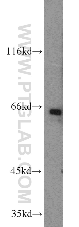 WB analysis of MCF-7 using 10228-1-AP