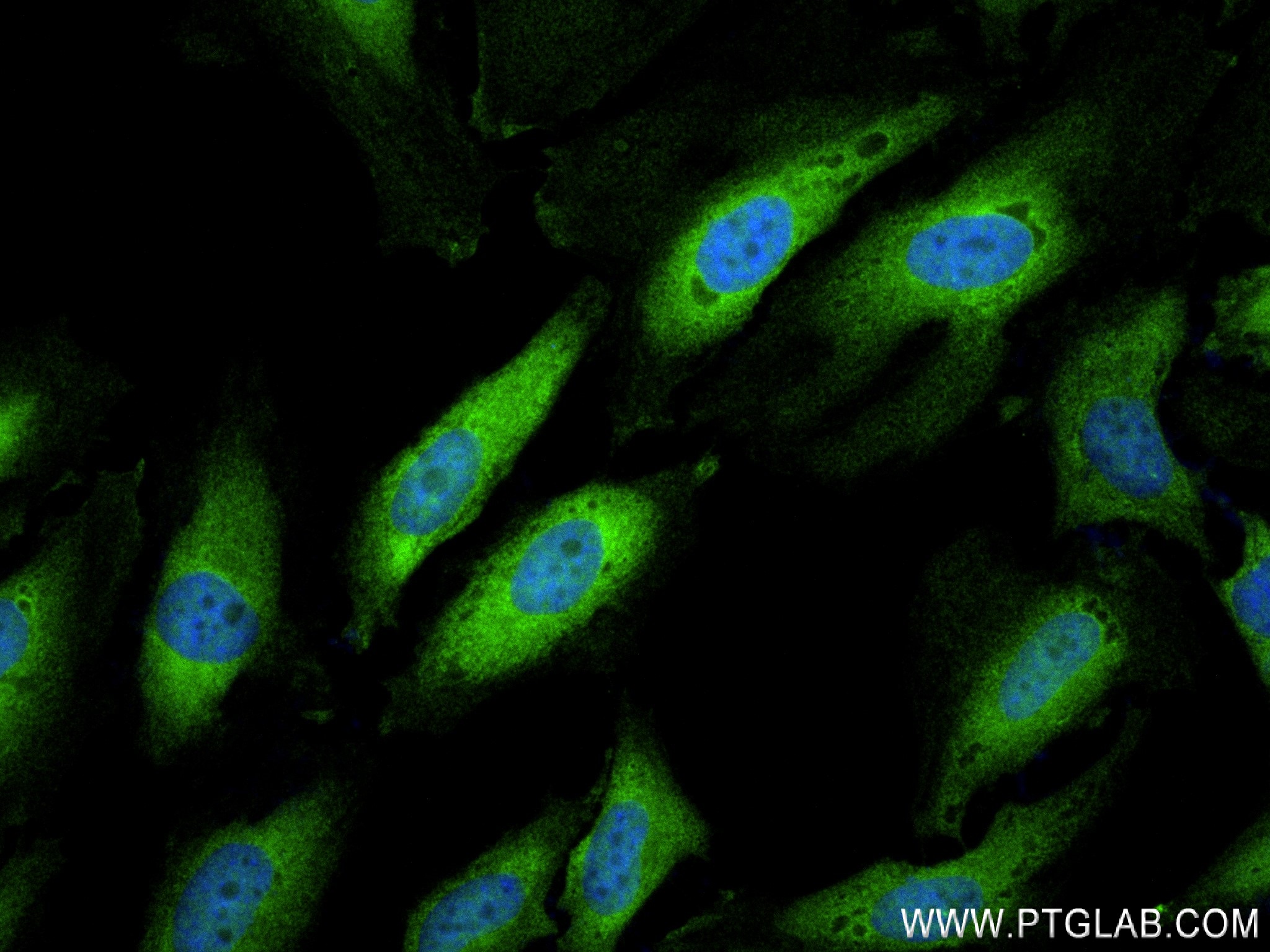 IF Staining of HepG2 using 83917-5-RR