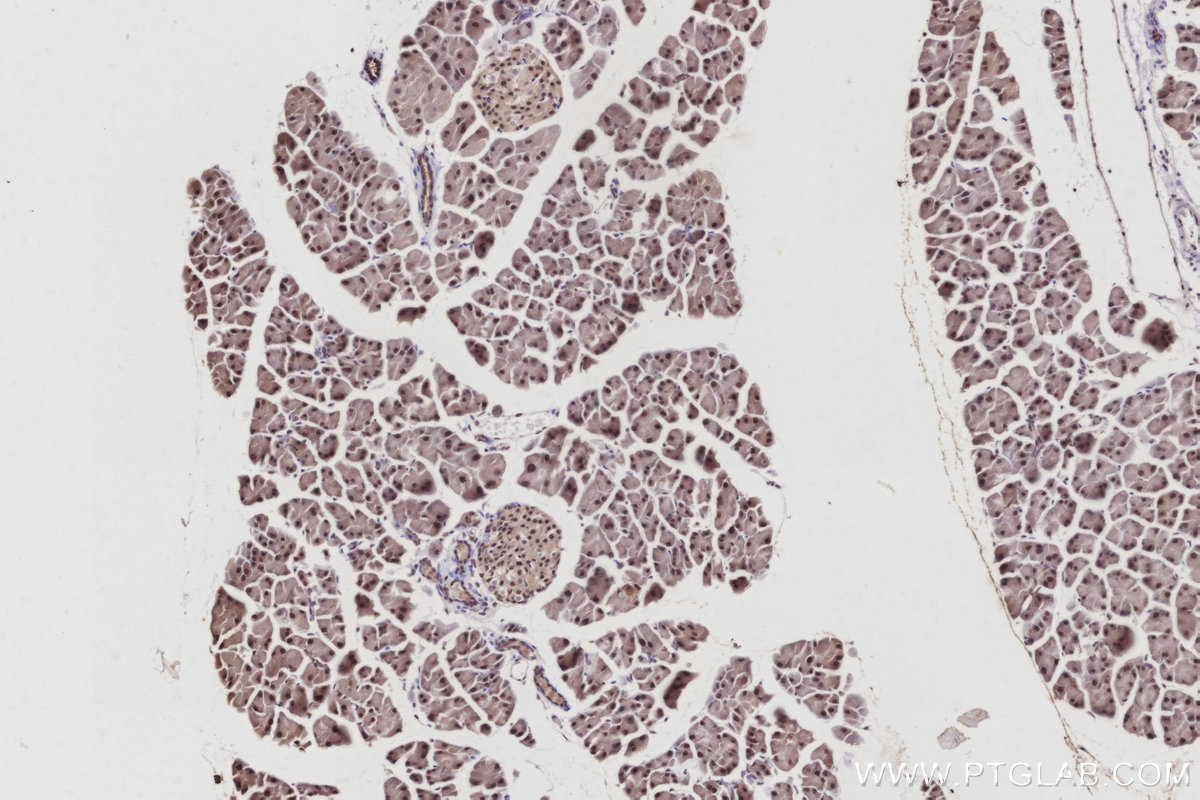 IHC staining of mouse pancreas using 10681-1-AP IHC staining of mouse pancreas using 10681-1-AP