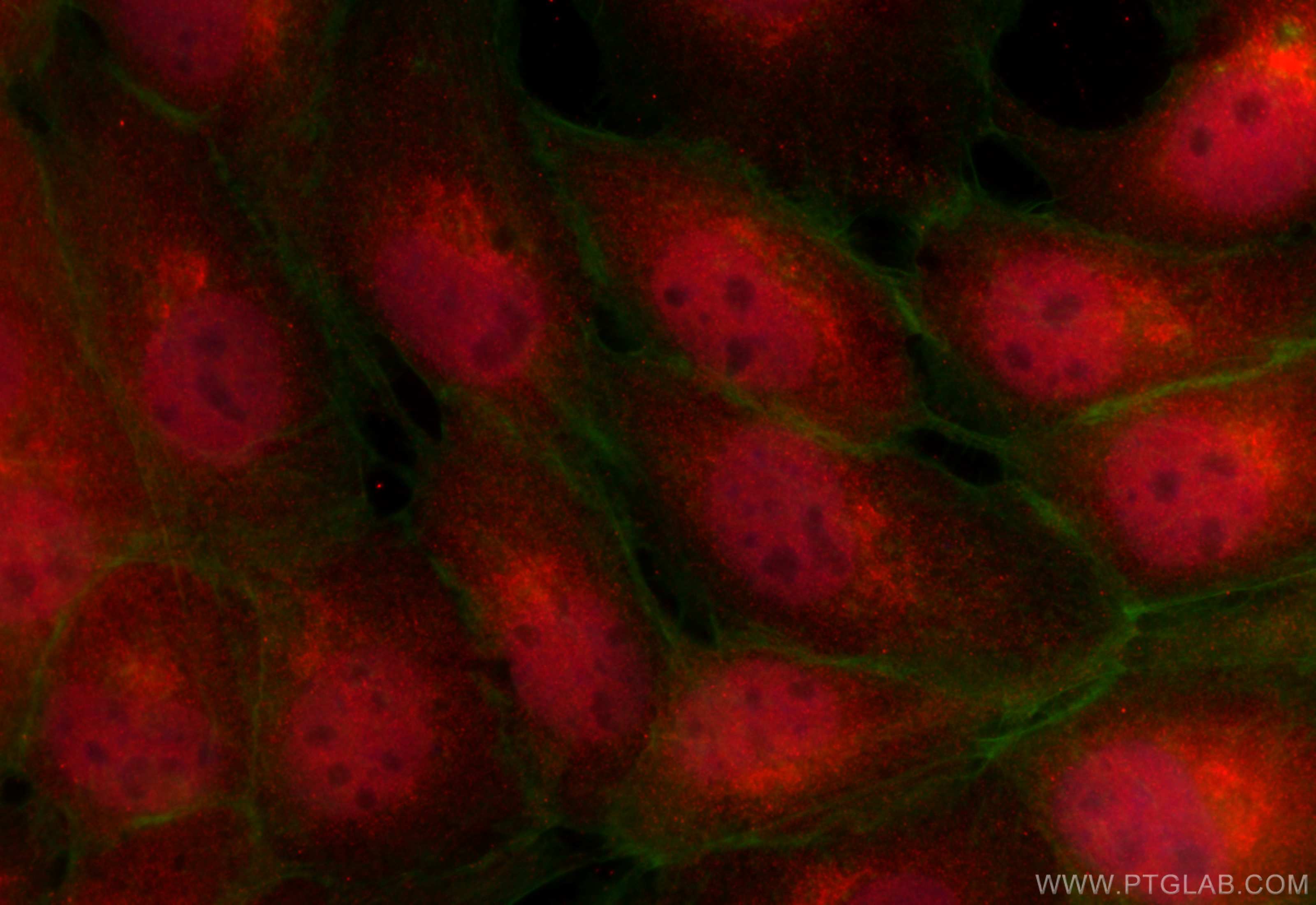 IF Staining of A431 using 32473-1-AP