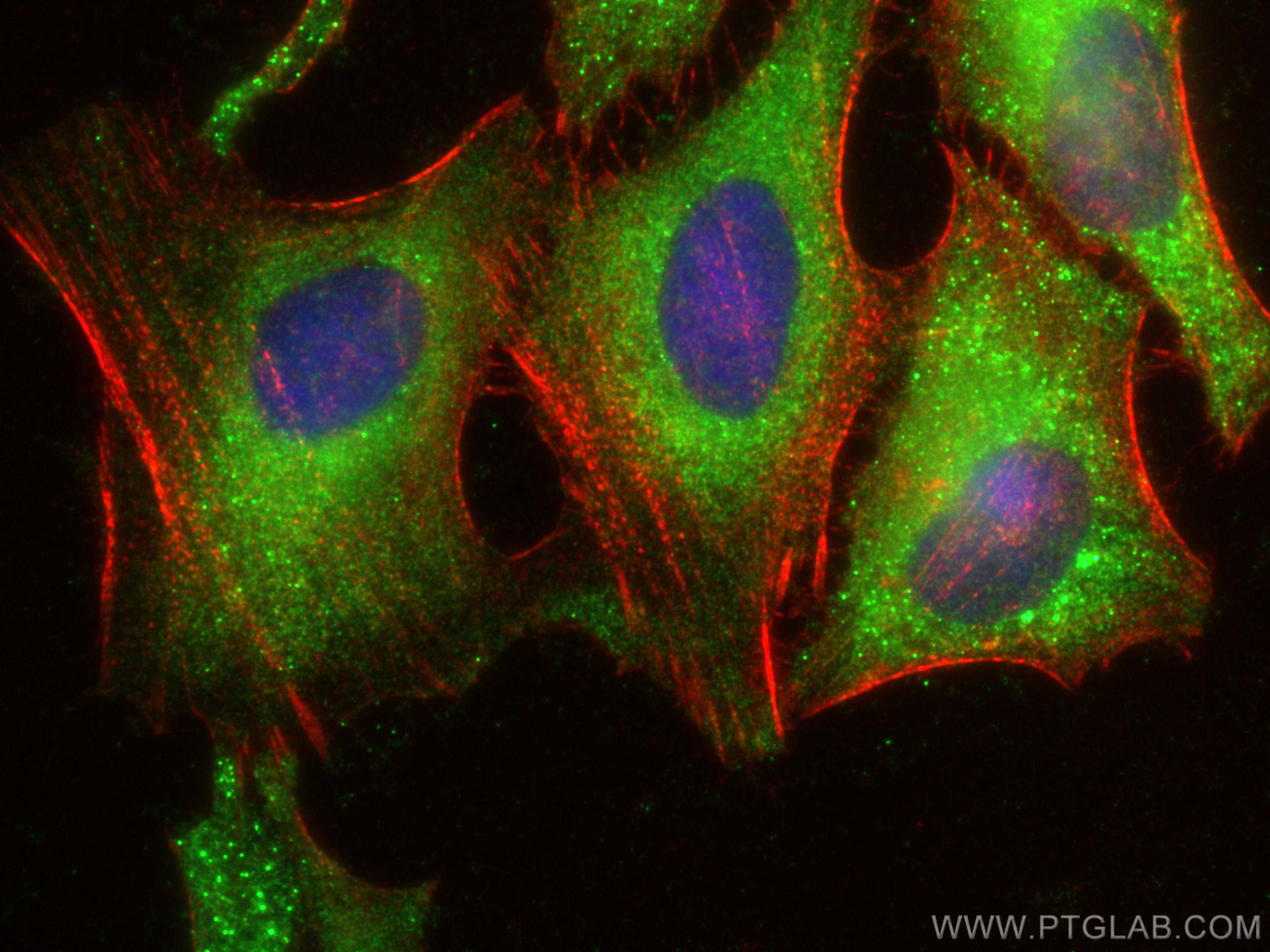 IF Staining of HeLa using 21205-1-AP