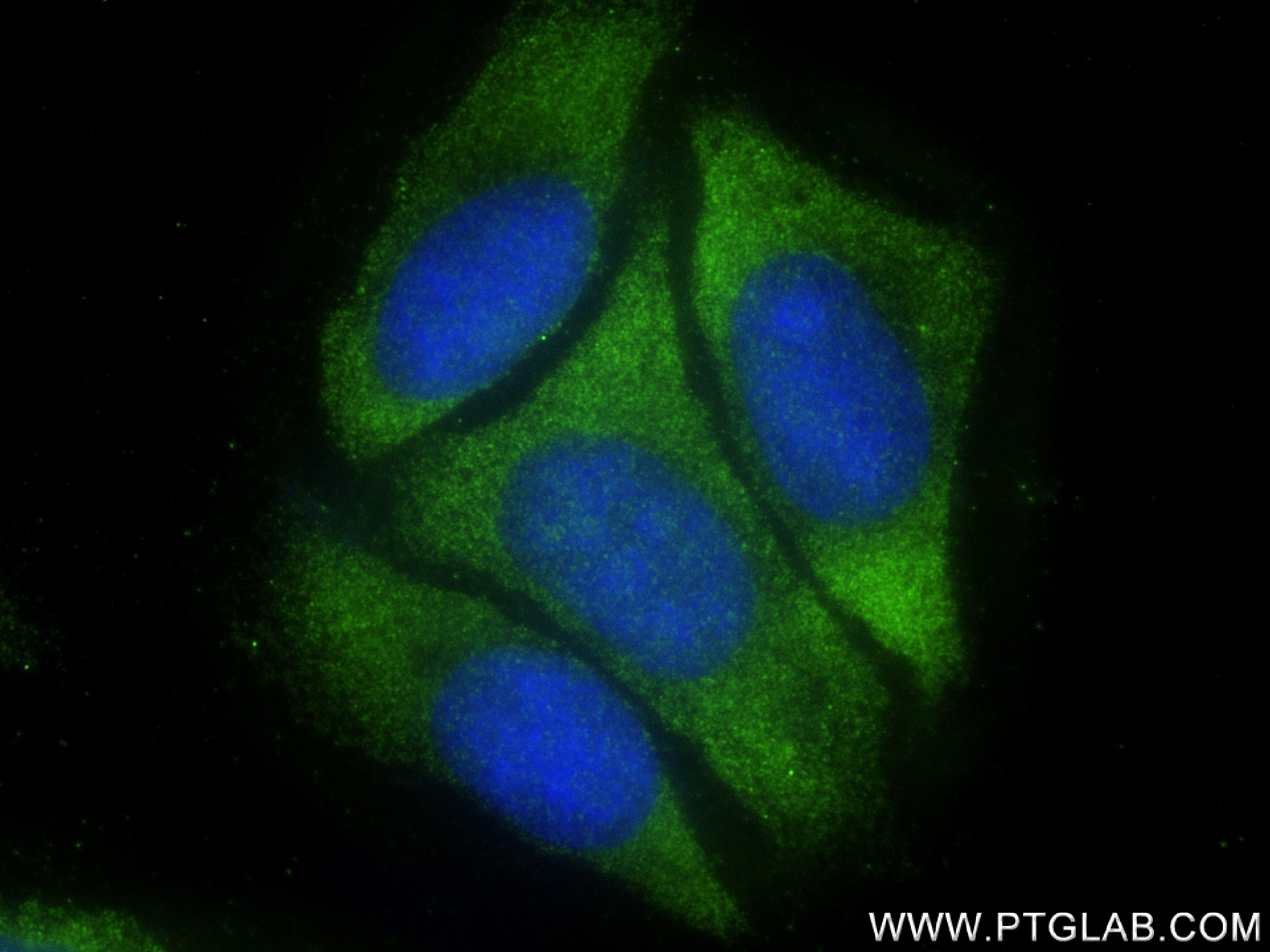 IF Staining of HepG2 using 83217-5-RR