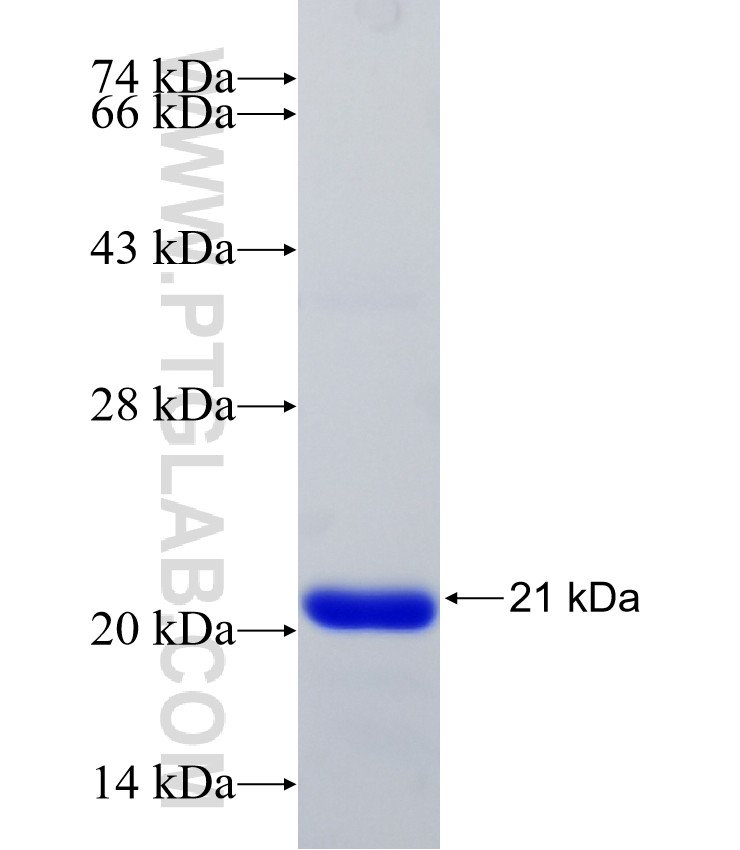 NUDCD2 fusion protein Ag15768 SDS-PAGE