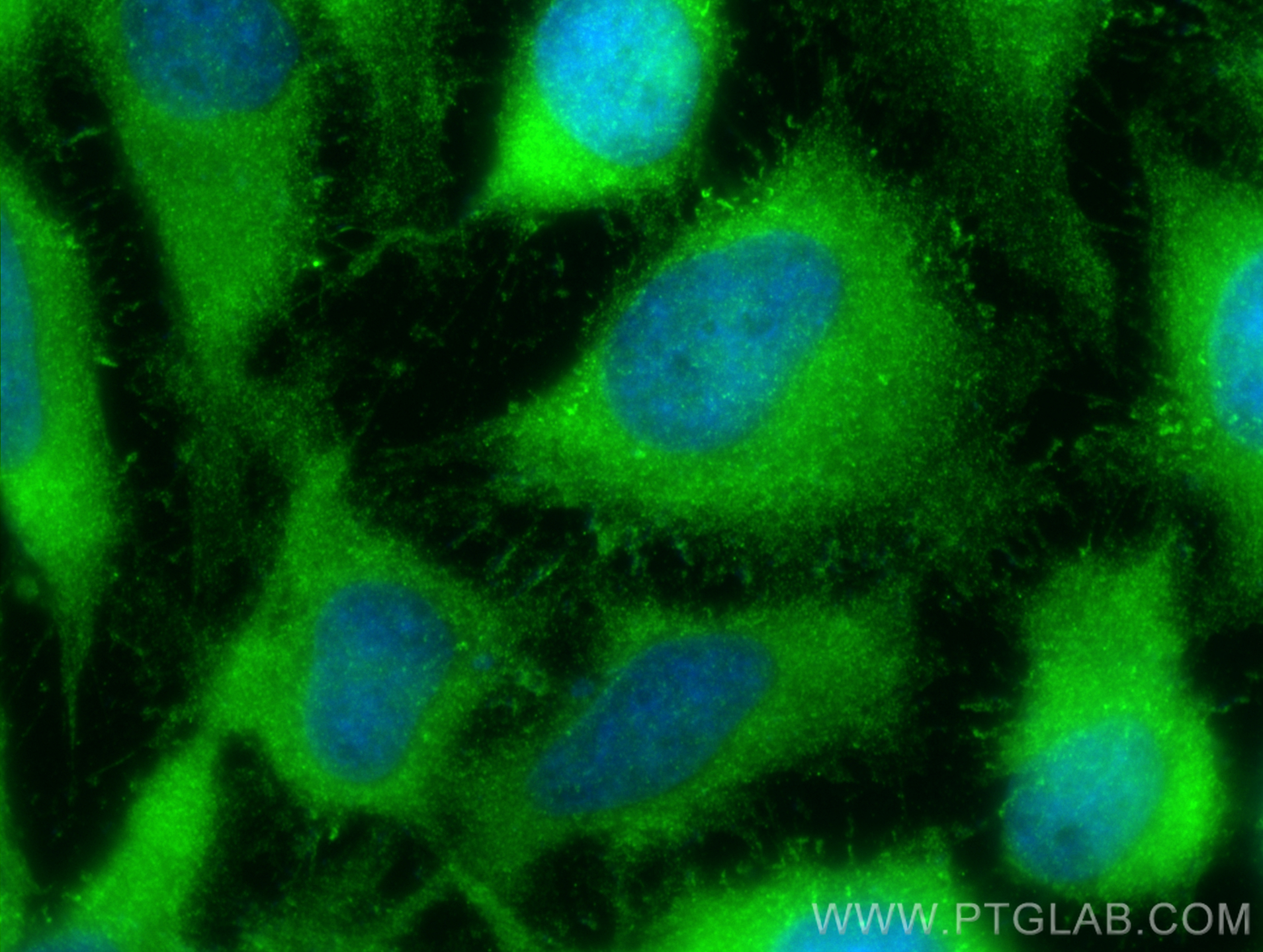 IF Staining of HeLa using 17508-1-AP