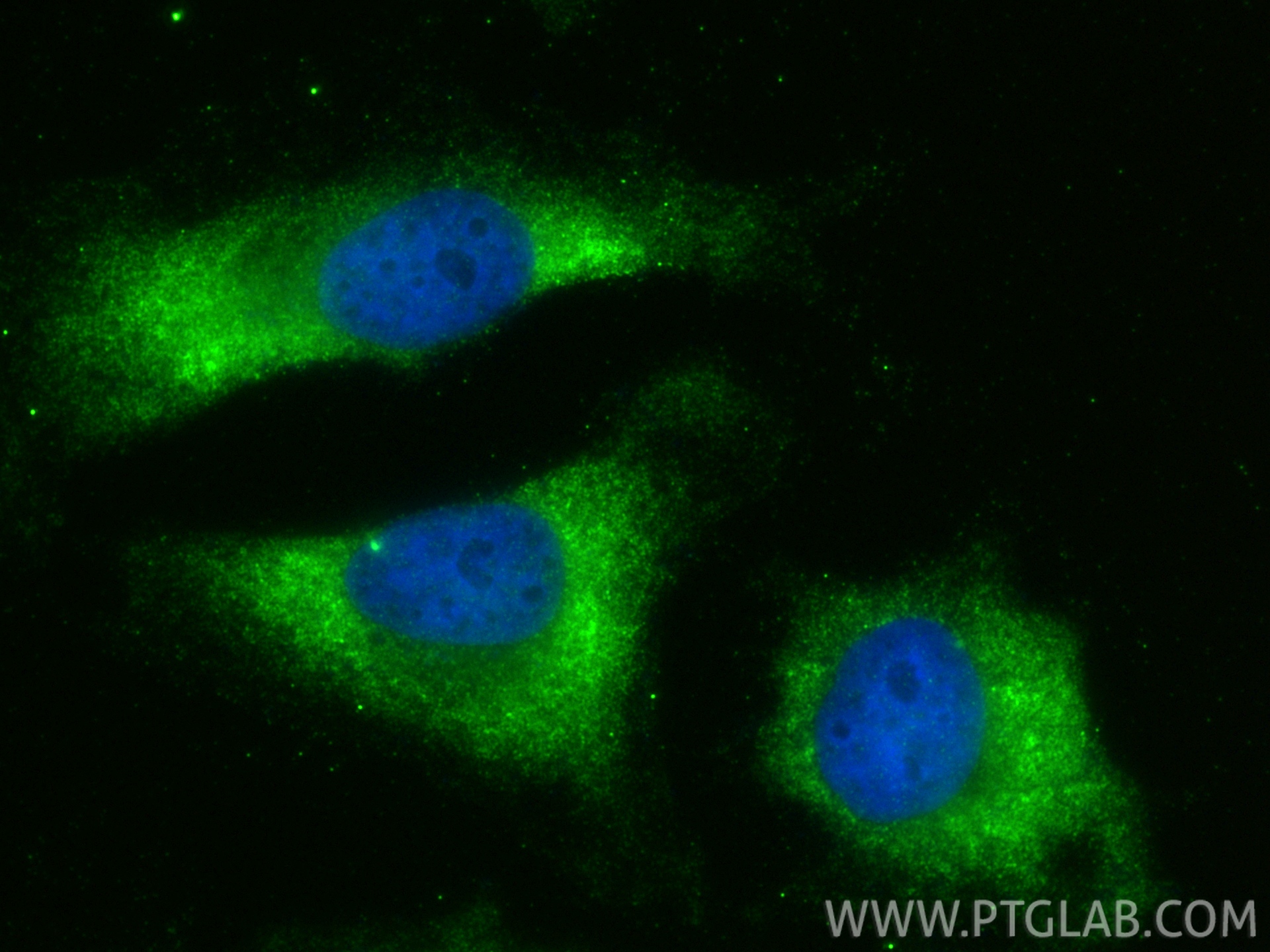 Immunofluorescent analysis of (-20°C Methanol) fixed HeLa cells using NUDT12 antibody (17487-1-AP) at dilution of 1:400 and CoraLite®488-Conjugated Goat Anti-Rabbit IgG(H+L) (<a class='green' href='/productredirect?CatalogNo=SA00013-2' target='_blank'>SA00013-2</a>). IF Staining of HeLa using 17487-1-AP