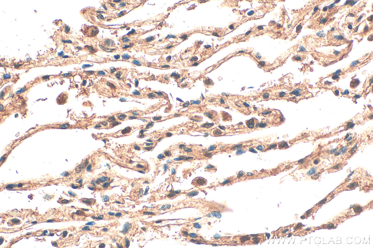 Immunohistochemical analysis of paraffin-embedded human lung tissue slide using 17487-1-AP (NUDT12 antibody) at dilution of 1:200 (under 40x lens). Heat mediated antigen retrieval with Tris-EDTA buffer (pH 9.0). IHC staining of human lung using 17487-1-AP