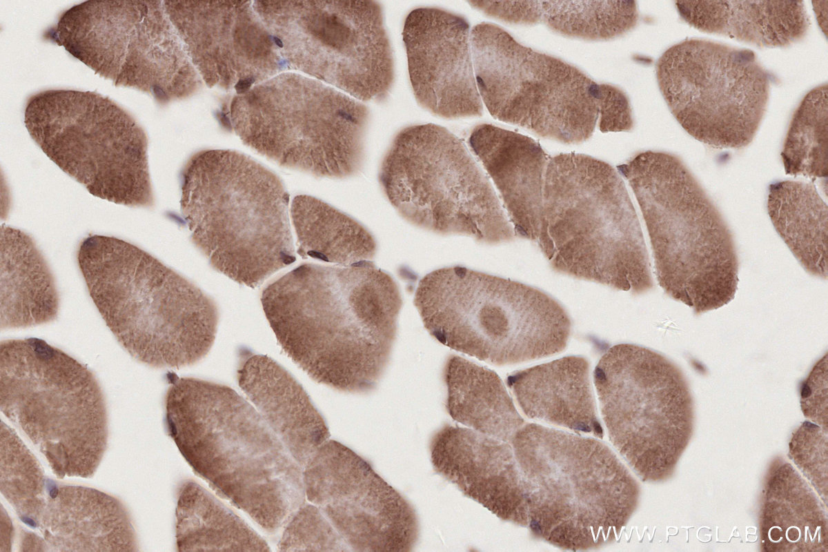 IHC staining of mouse skeletal muscle using 12889-1-AP IHC staining of mouse skeletal muscle using 12889-1-AP