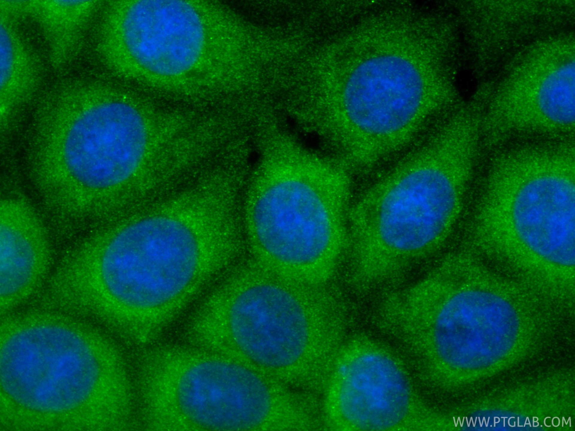 IF Staining of MCF-7 using 18805-1-AP IF Staining of MCF-7 using 18805-1-AP