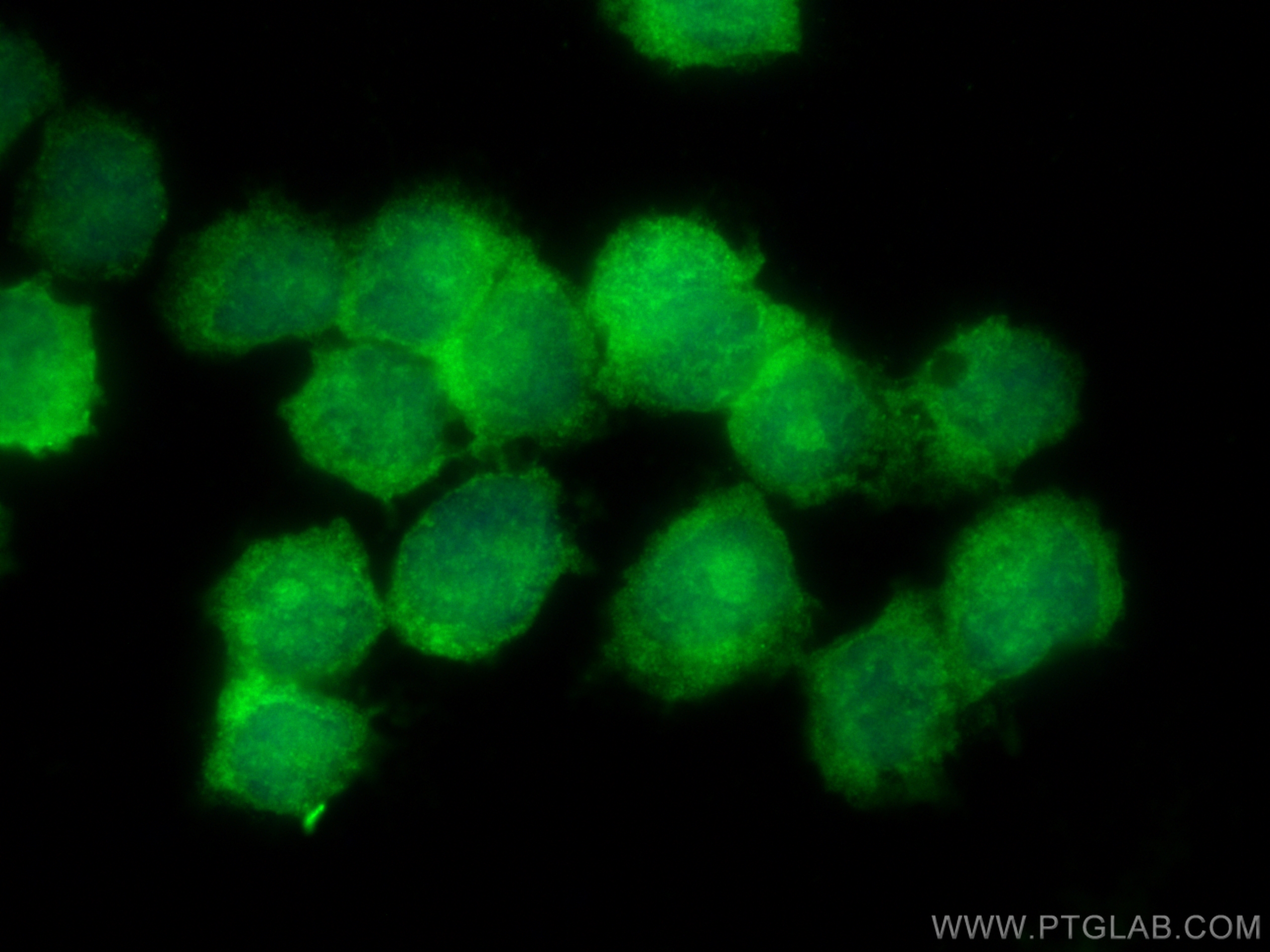 IF Staining of THP-1 using 17318-1-AP