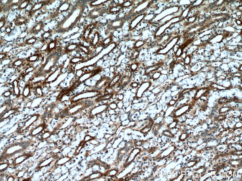 IHC staining of human kidney using 55126-1-AP