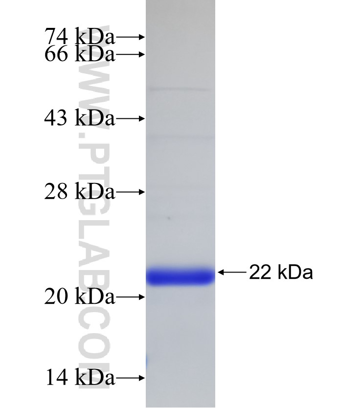 NUDT2 fusion protein Ag33167 SDS-PAGE NUDT2 fusion protein Ag33167 SDS-PAGE