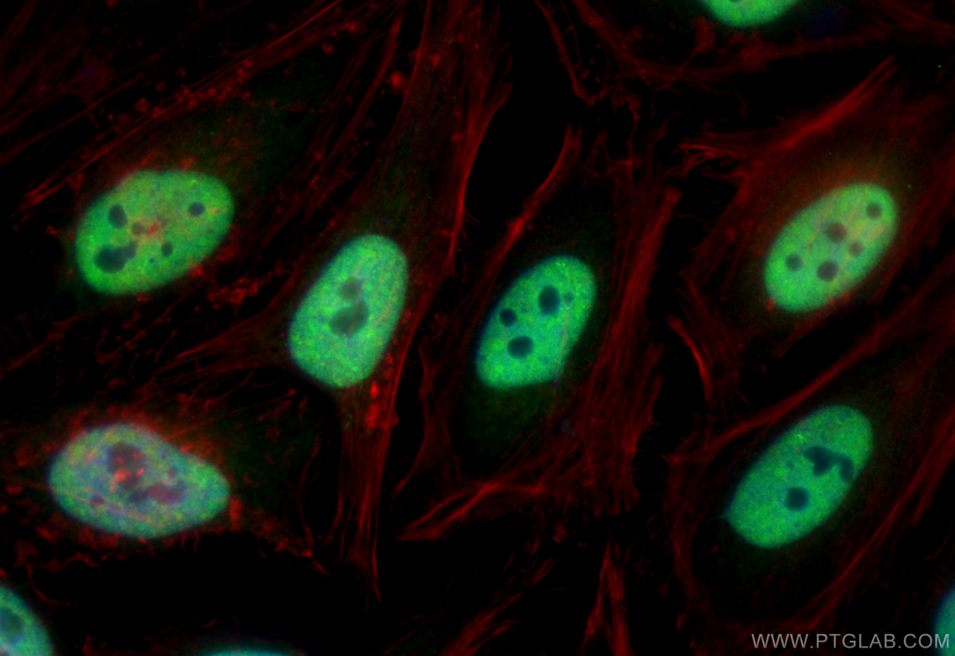IF Staining of HeLa using 10322-1-AP