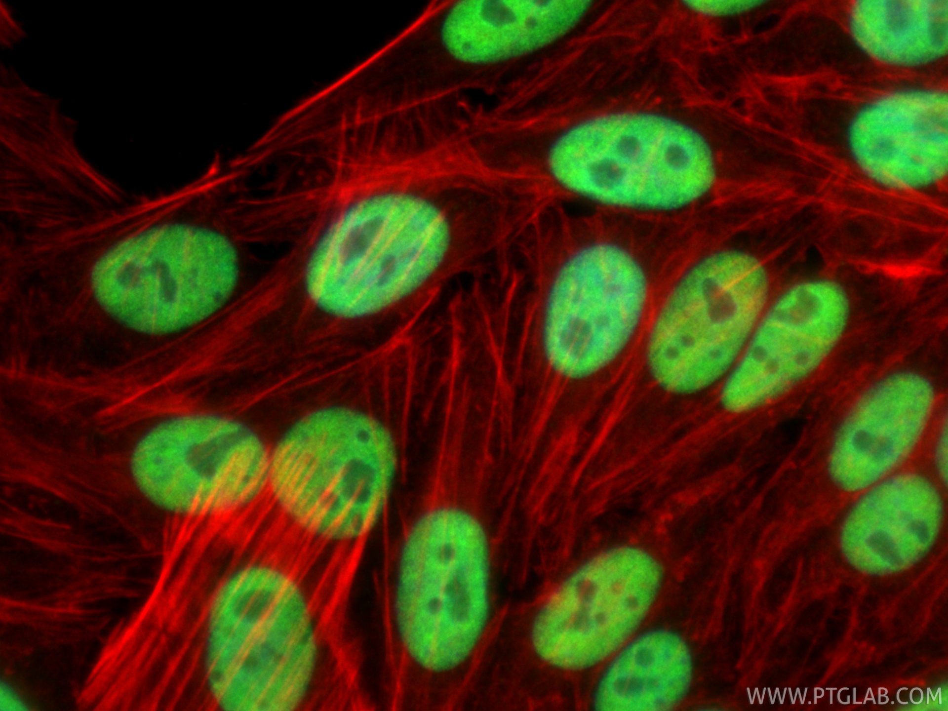 IF Staining of HepG2 using 10322-1-AP IF Staining of HepG2 using 10322-1-AP