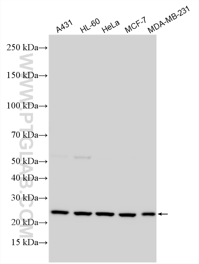 WB analysis using 10322-1-AP