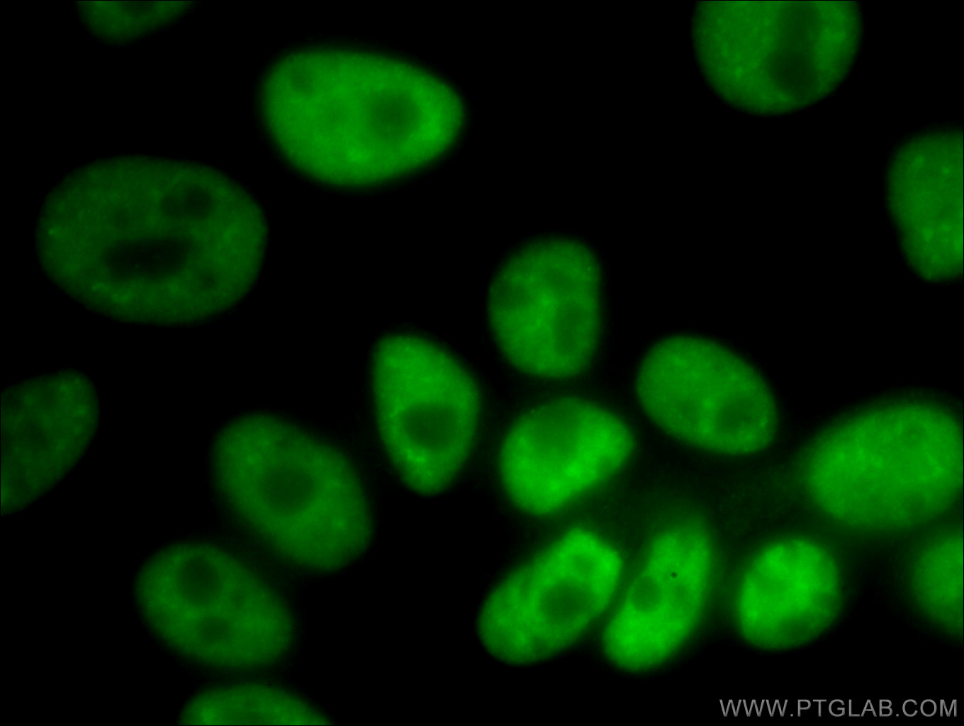 IF Staining of HepG2 using 66335-1-Ig