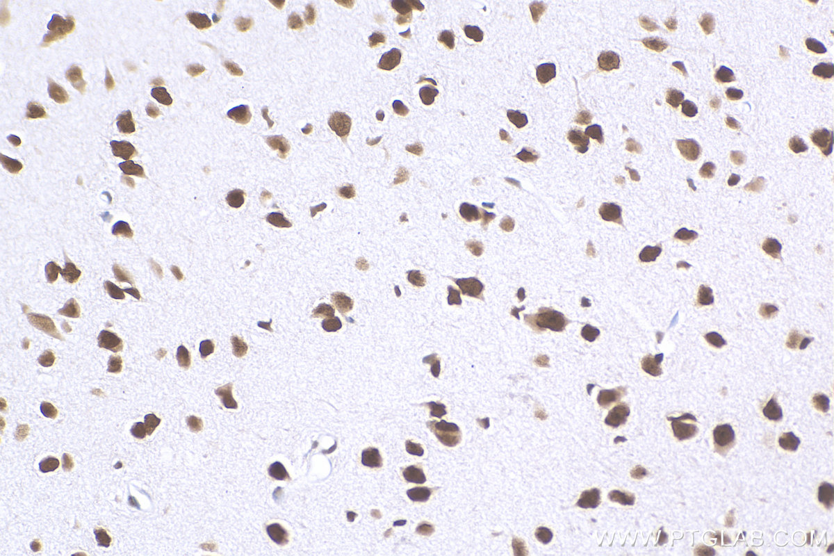 IHC staining of mouse brain using 66335-1-Ig