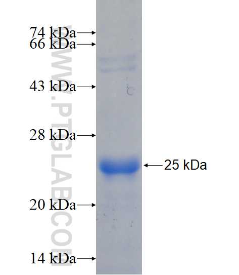 NUDT3 fusion protein Ag15163 SDS-PAGE NUDT3 fusion protein Ag15163 SDS-PAGE