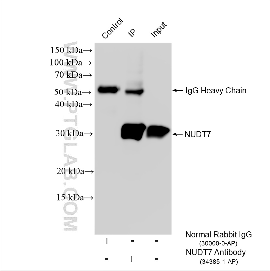 IP experiment of mouse liver using 34385-1-AP