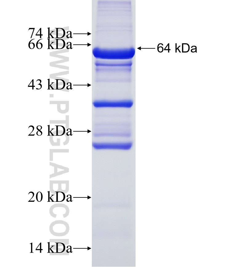 NUF2 fusion protein Ag8479 SDS-PAGE