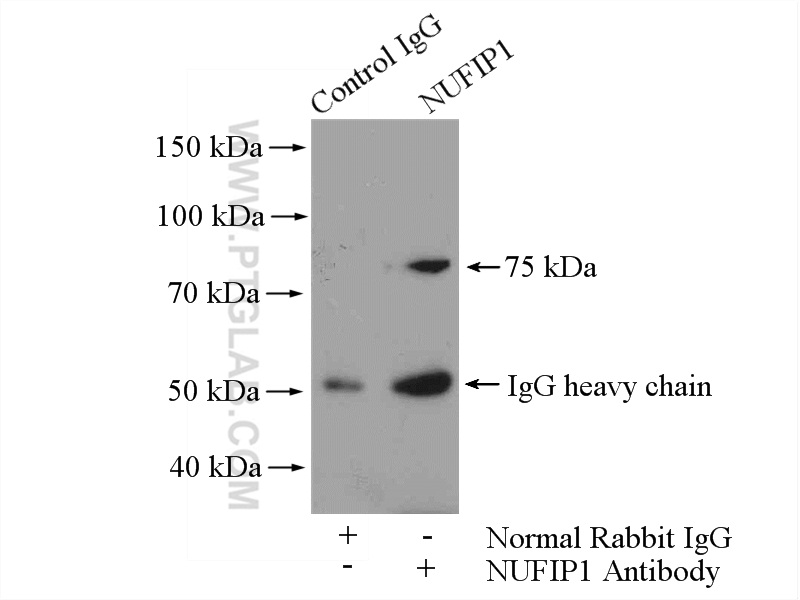 IP experiment of HeLa using 12515-1-AP